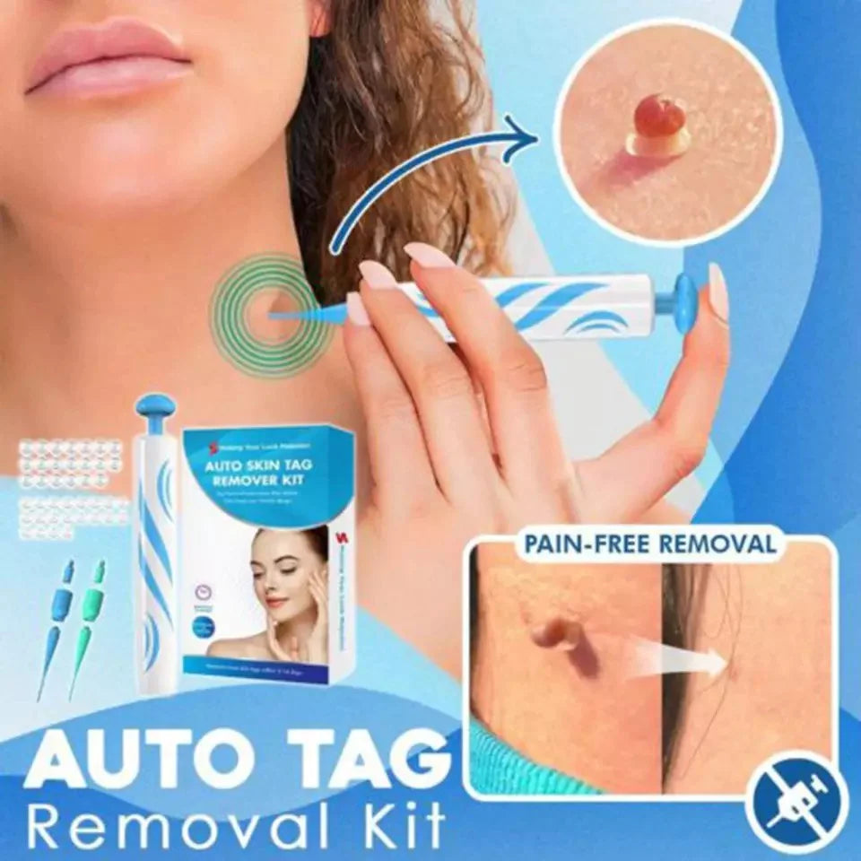 Skin Tag Removal Kit with Applicator Device and Replacement Bands for Small and Regular Skin Tags