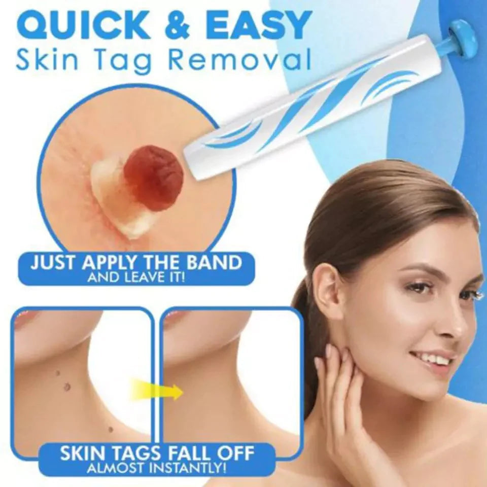 Skin Tag Removal Kit with Applicator Device and Replacement Bands for Small and Regular Skin Tags