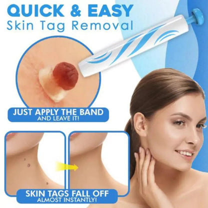 Skin Tag Removal Kit with Applicator Device and Replacement Bands for Small and Regular Skin Tags