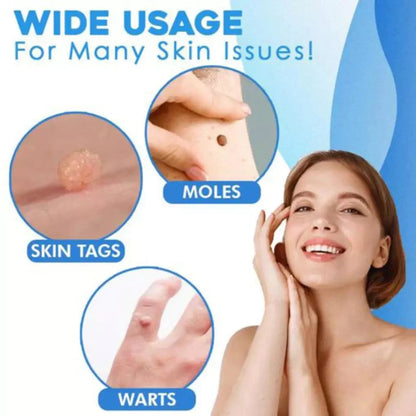 Skin Tag Removal Kit with Applicator Device and Replacement Bands for Small and Regular Skin Tags
