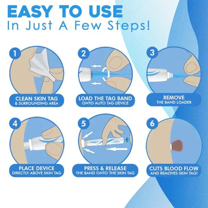 Skin Tag Removal Kit with Applicator Device and Replacement Bands for Small and Regular Skin Tags